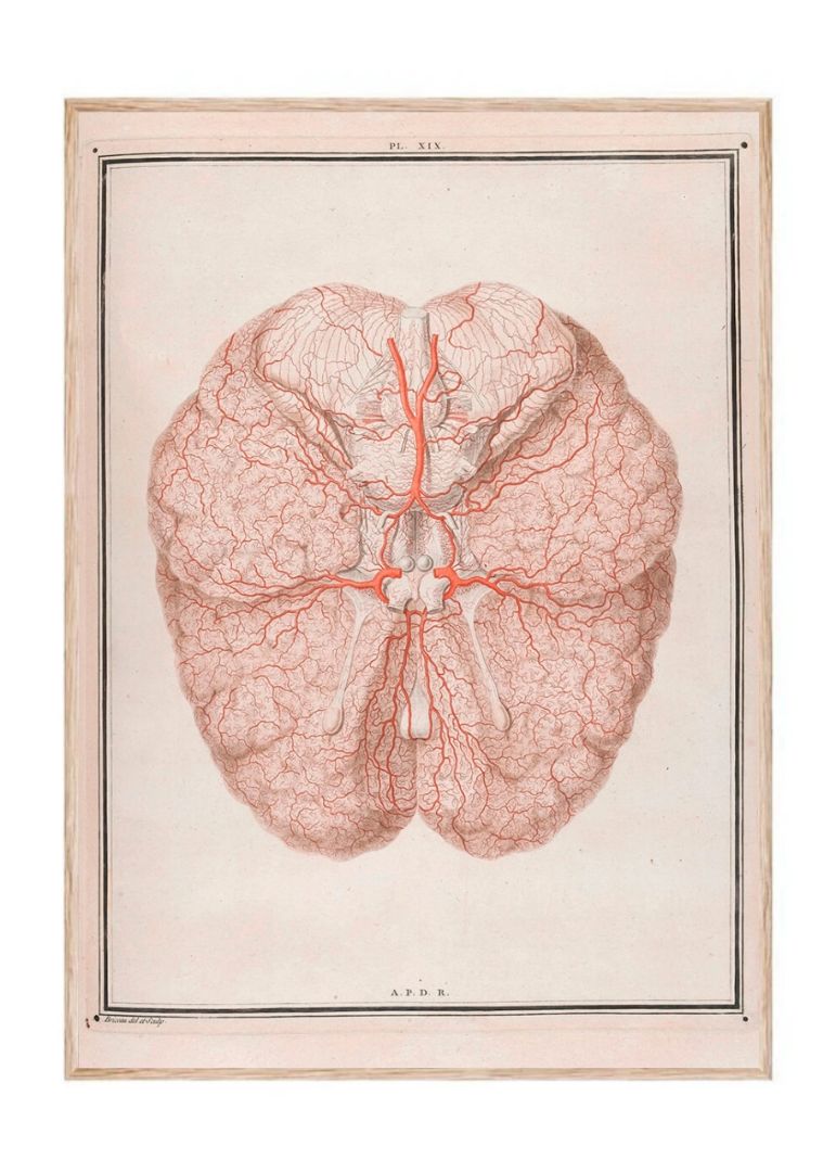 Colour Illustration of Arteries at the Base of the Brain