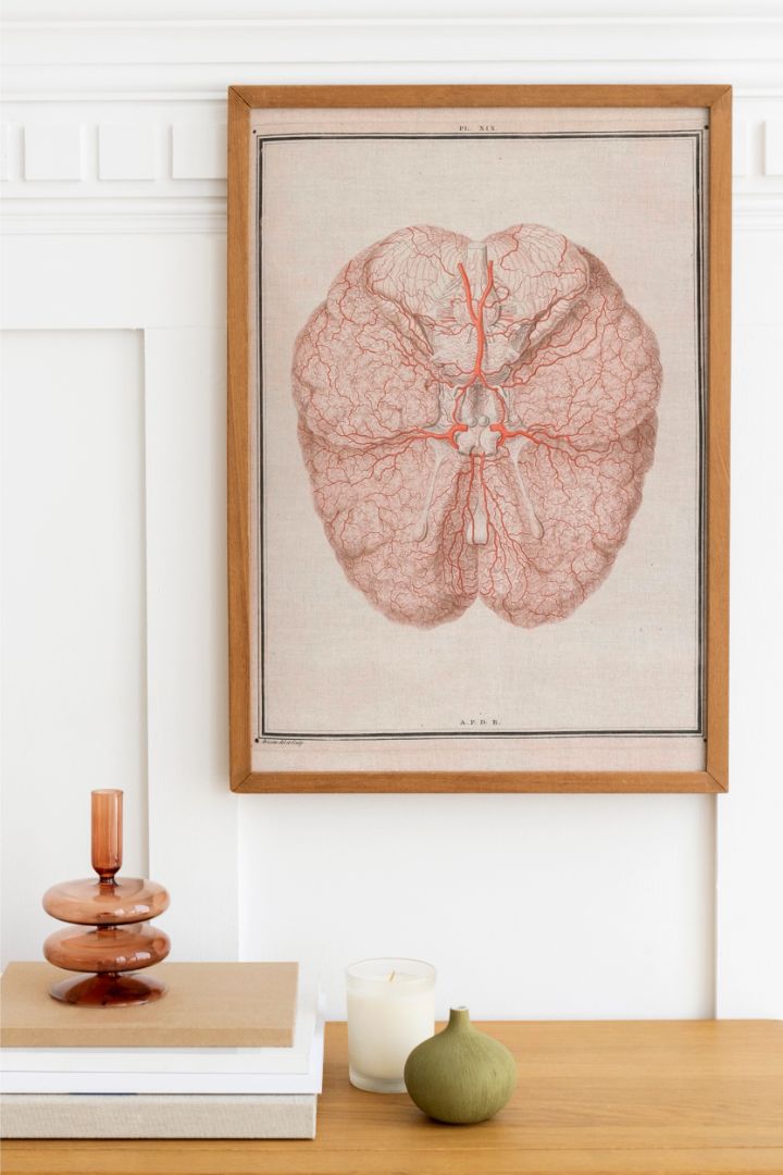 Colour Illustration of Arteries at the Base of the Brain