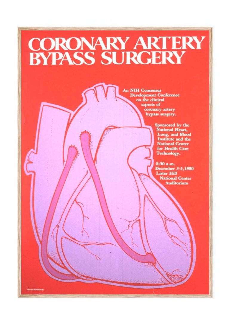 Coronary artery bypass surgery