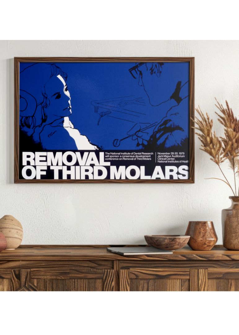 Removal of third molars