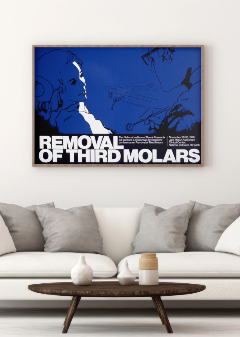 Removal of third molars