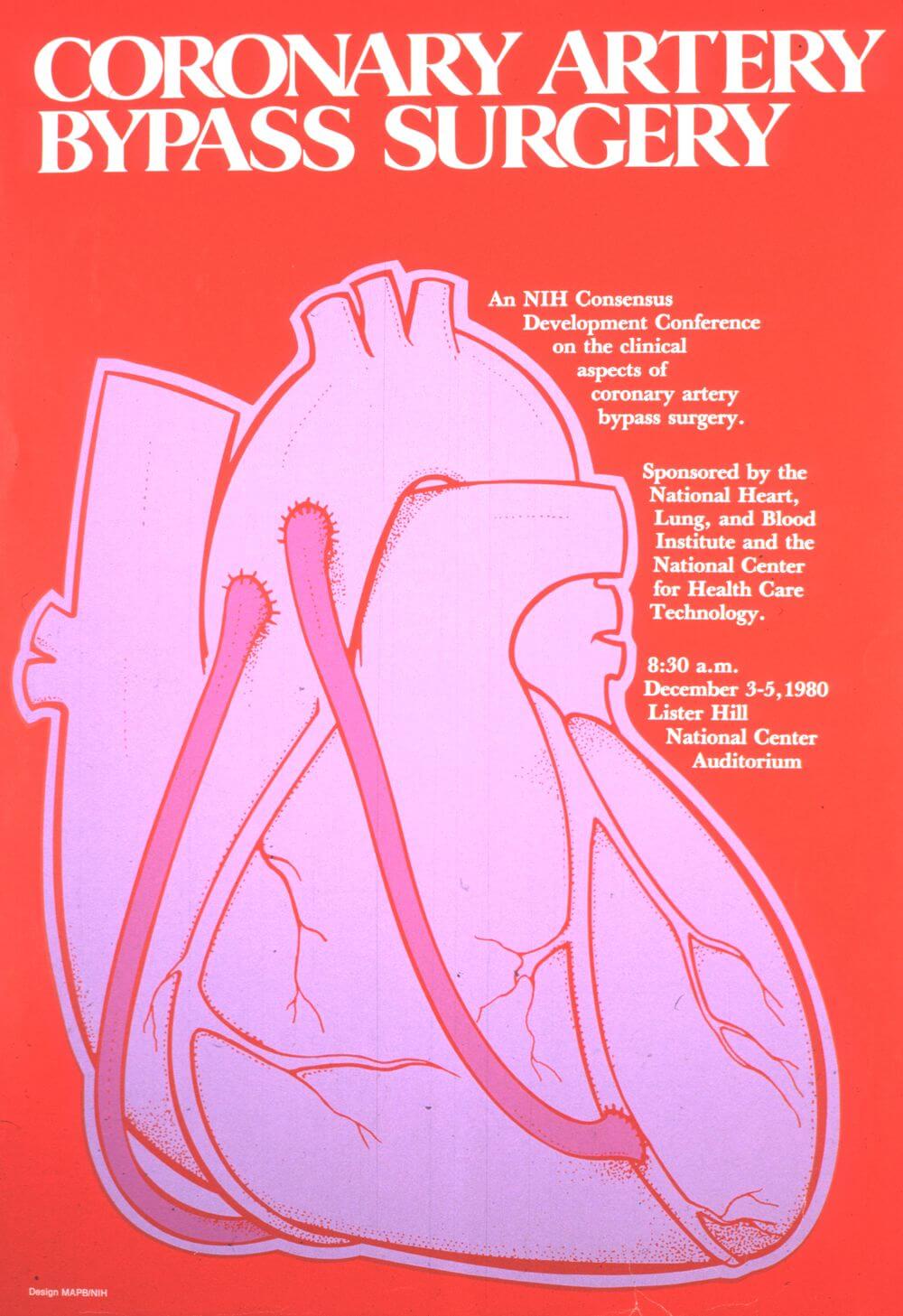 Coronary artery bypass surgery